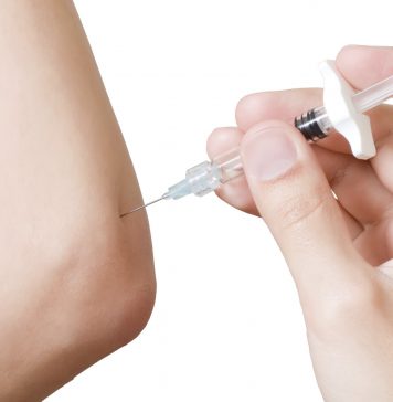 PRP (plasma) injecties bij een chronische tennisarm