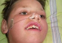 Zuurstoftherapie helpt 10-jarige met hersenletsel