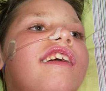 Zuurstoftherapie helpt 10-jarige met hersenletsel