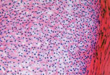 2 miljoen voor Utrechts kraakbeenonderzoek