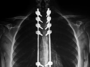 Erasmus MC en LUMC werken samen in orthopedie