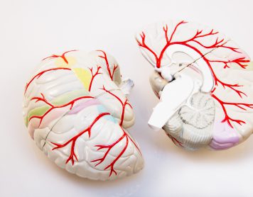 Hersenrevalidatie verbetert kwaliteit van leven na hartstilstand