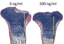 Oefeningen maken je botten niet veel steviger