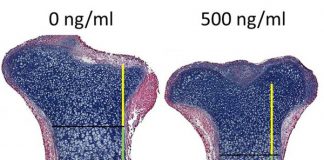 Oefeningen maken je botten niet veel steviger
