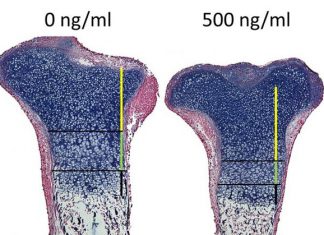 Oefeningen maken je botten niet veel steviger