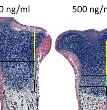 Oefeningen maken je botten niet veel steviger