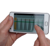 SensiStep bevordert revalidatie na gebroken been of heup