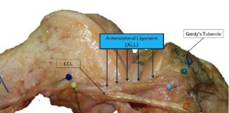 Belgische chirurgen ontdekken anterolateraal ligament in de knie Een foto van een rechterknie na een volledige dissectie van de ALL-gewrichtsband