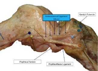 Belgische chirurgen ontdekken anterolateraal ligament in de knie Een foto van een rechterknie na een volledige dissectie van de ALL-gewrichtsband