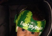 Helmbehandeling baby’s niet effectief Foto van https://www.facebook.com/pages/Lazardo-Art-and-the-art-of-baby-helmet-painting/207828829280728