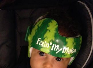 Helmbehandeling baby’s niet effectief Foto van https://www.facebook.com/pages/Lazardo-Art-and-the-art-of-baby-helmet-painting/207828829280728