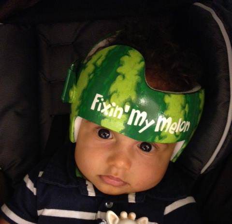 Helmbehandeling baby’s niet effectief Foto van https://www.facebook.com/pages/Lazardo-Art-and-the-art-of-baby-helmet-painting/207828829280728