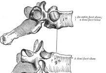 Fysiotherapie net zo effectief als een OK bij lumbale stenose