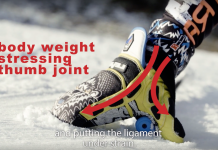 Chirurg bedenkt handschoen tegen ski-duim