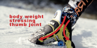 Chirurg bedenkt handschoen tegen ski-duim