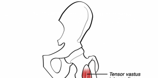 De ontdekking van de musculus Tensor Vastus Intermedius
