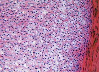 Stukjes gewricht uit de diepvries Peesweefsel