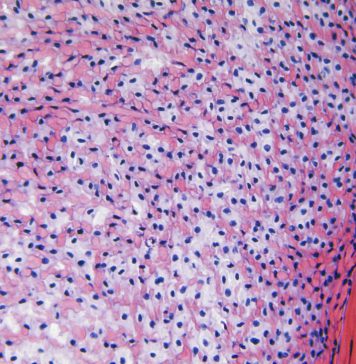 Waarom je kraakbeen verliest als je niet beweegt Peesweefsel