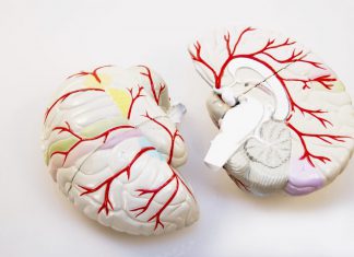 Overlijdenskans na een herseninfarct op jonge leeftijd duidelijk gedaald hersenen