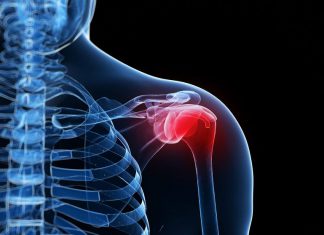 De SNN Praktijkrichtlijn Frozen Shoulder