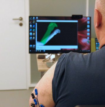 Virtual reality helpt bij fantoompijn