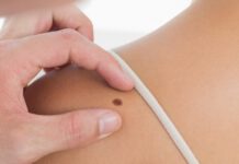 Cursus dermatologie voor de fysiotherapeut