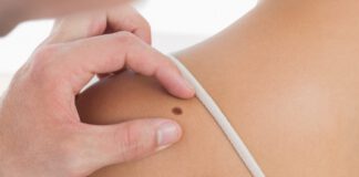 Cursus dermatologie voor de fysiotherapeut