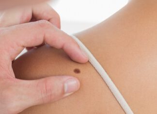 Cursus dermatologie voor de fysiotherapeut