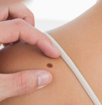 Cursus dermatologie voor de fysiotherapeut