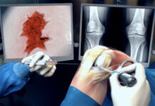 Kraakbeenherstel door nieuwe toepassing