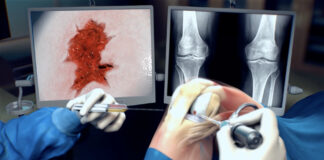 Kraakbeenherstel door nieuwe toepassing