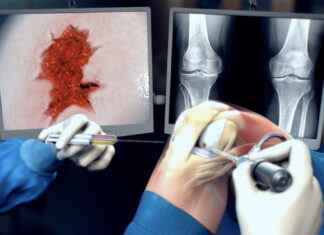 Kraakbeenherstel door nieuwe toepassing