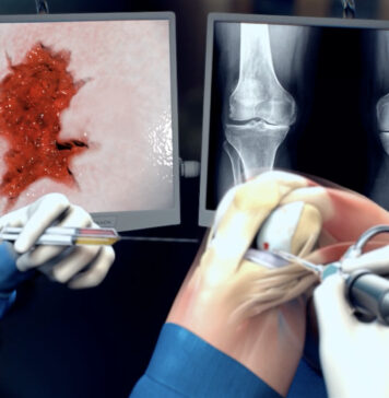 Kraakbeenherstel door nieuwe toepassing