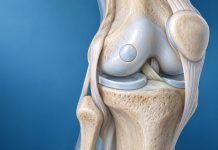 UMC Utrecht voert eerste Nederlandse bot-kraakbeentransplantatie in knie uit
