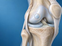 UMC Utrecht voert eerste Nederlandse bot-kraakbeentransplantatie in knie uit