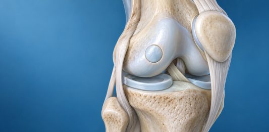 UMC Utrecht voert eerste Nederlandse bot-kraakbeentransplantatie in knie uit